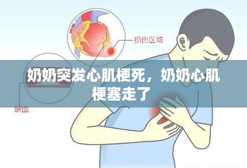 奶奶突發(fā)心肌梗死，奶奶心肌梗塞走了 
