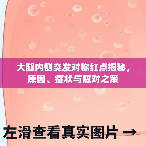 大腿內(nèi)側(cè)突發(fā)對稱紅點揭秘，原因、癥狀與應(yīng)對之策