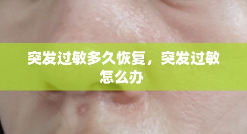 突發(fā)過(guò)敏多久恢復(fù)，突發(fā)過(guò)敏怎么辦 