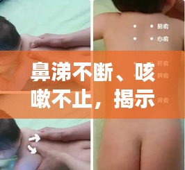 鼻涕不斷、咳嗽不止，揭示癥狀背后的健康隱患