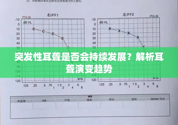 突發(fā)性耳聾是否會持續(xù)發(fā)展？解析耳聾演變趨勢